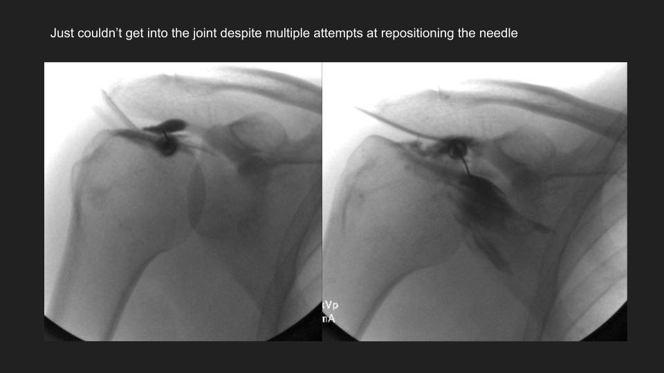 Figure 2 for case dislocation ( RID4770 )